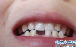 做梦掉牙齿(做梦掉牙齿掉一大把怎么回事)