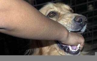 被狗咬(被自己家的狗咬了要打几针)