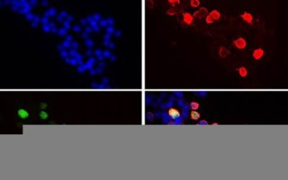 ab型血人的性格特点(AB型血人的性格特点女性)